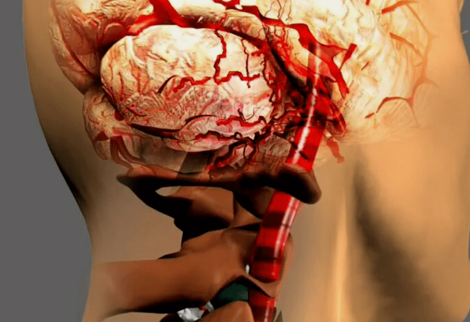 As a cervical osteochondrosis, it is dangerous