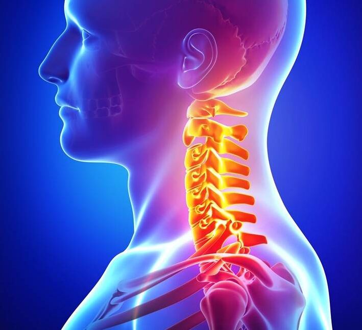 Osteochondrosis of the cervical spine